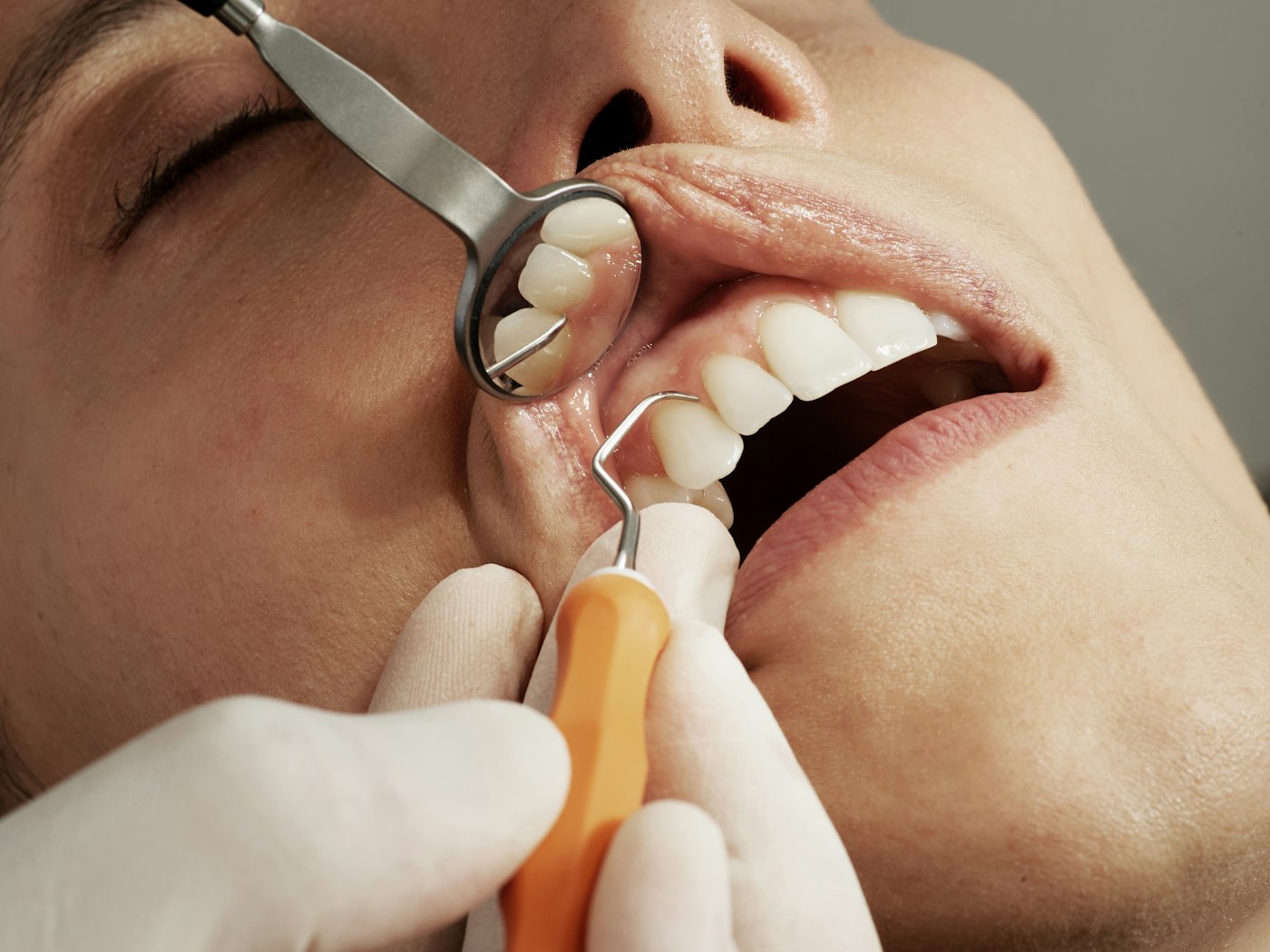 Dental Clinic website template preview